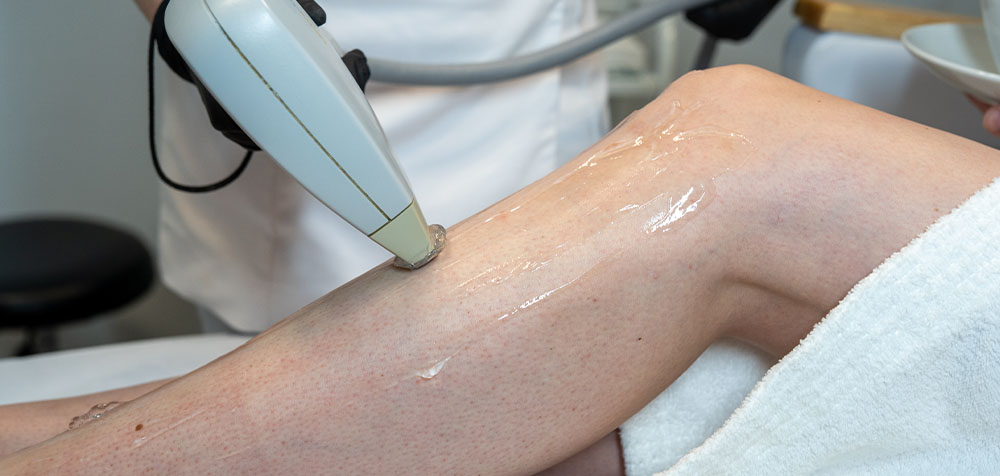 depilacja laserowa Szczecin Luxor Lasers