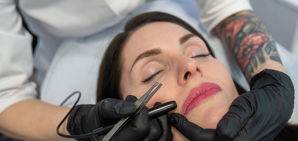 elektroepilacja Szczecin Luxor Lasers