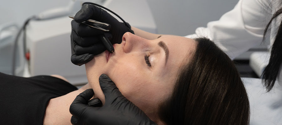 Elektroepilacja twarzy Szczecin – trwałe usuwanie owłosienia